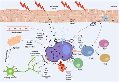 Mast cells as important regulators in the development of psoriasis